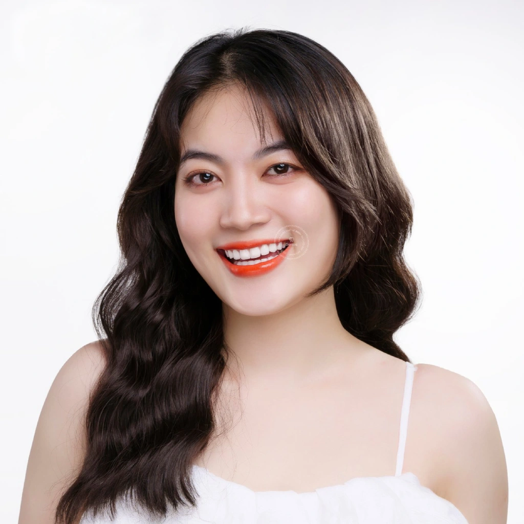 Nụ cười hoàn hảo sau quy trình bọc răng sứ chuẩn tại Dentos